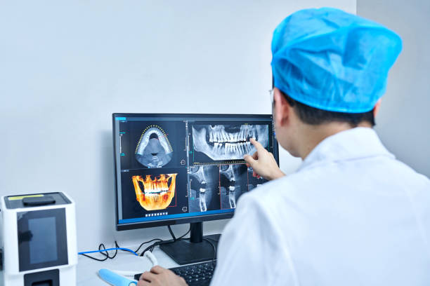 Best Chipped Tooth Repair Near Me  in Williams, OR